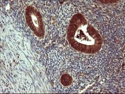 Immunohistochemistry: SIVA Antibody (OTI2F8) - Azide and BSA Free [NBP2-74208]