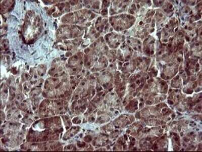 Immunohistochemistry: SIVA Antibody (OTI2F8) - Azide and BSA Free [NBP2-74208]