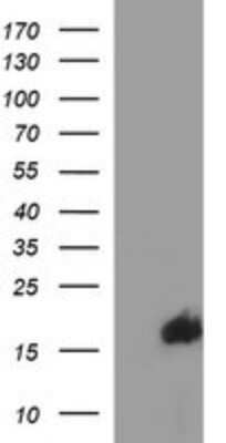 Western Blot: SIVA Antibody (OTI2F8)Azide and BSA Free [NBP2-74208]