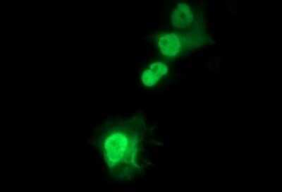 Immunocytochemistry/ Immunofluorescence: SIVA Antibody (OTI2F8) [NBP2-45850]