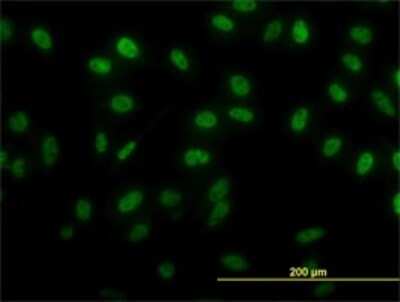 Immunocytochemistry/ Immunofluorescence: SIX4 Antibody (5E1) [H00051804-M07]