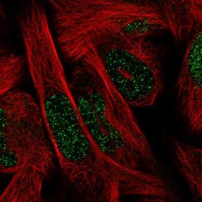 Immunocytochemistry/ Immunofluorescence: SIX1 Antibody (CL0185) [NBP2-52873]