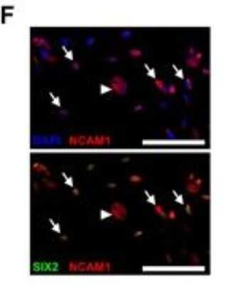 Immunocytochemistry/ Immunofluorescence: SIX2 Antibody (3D7) [H00010736-M01]
