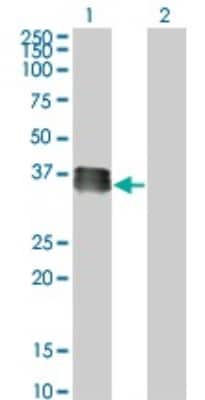 Western Blot: SIX2 Antibody (3D7) [H00010736-M01]