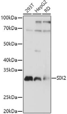 Western Blot: SIX2 AntibodyAzide and BSA Free [NBP2-94801]