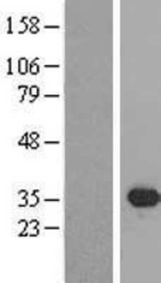 Western Blot: SIX2 Overexpression Lysate [NBL1-15983]