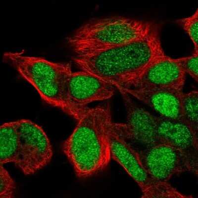 Immunocytochemistry/ Immunofluorescence: SIX6 Antibody [NBP1-82478]