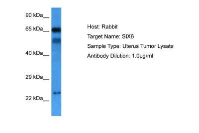 Western Blot: SIX6 Antibody [NBP2-83525]