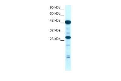 Western Blot: SIX6 Antibody [NBP2-83529]