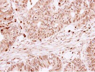 Immunohistochemistry-Paraffin: SKAP55 Antibody [NBP1-32479]