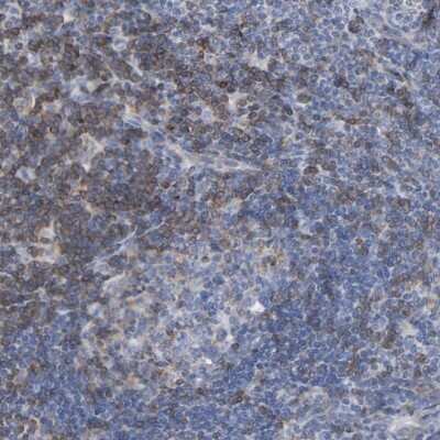 Immunohistochemistry-Paraffin: SKAP55 Antibody [NBP1-87836]