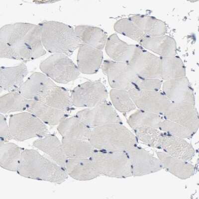 Immunohistochemistry-Paraffin: SKAP55 Antibody [NBP1-87836]