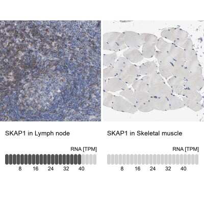 Immunohistochemistry-Paraffin: SKAP55 Antibody [NBP1-87836]