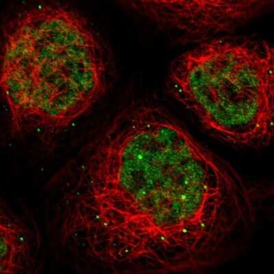Immunocytochemistry/ Immunofluorescence: SKAR Antibody [NBP1-92392]
