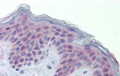 Immunohistochemistry-Paraffin: SKAR Antibody [NBP1-57411]