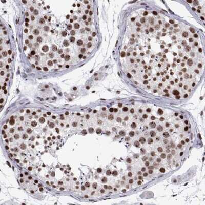 Immunohistochemistry-Paraffin: SKAR Antibody [NBP2-58732]