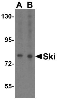 Western Blot: SKI AntibodyBSA Free [NBP1-77305]