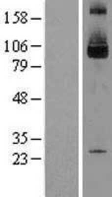 Western Blot: SKI Overexpression Lysate [NBL1-15989]