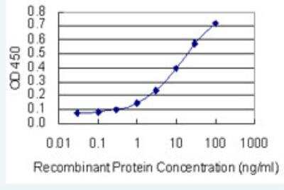 ELISA: SKIV2L Antibody (1E5) [H00006499-M05-50ug]