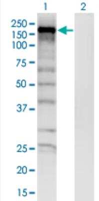 Western Blot: SKIV2L Antibody (1E5) [H00006499-M05-50ug]