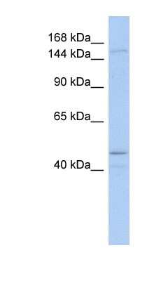 Western Blot: SKIV2L Antibody [NBP1-57119]