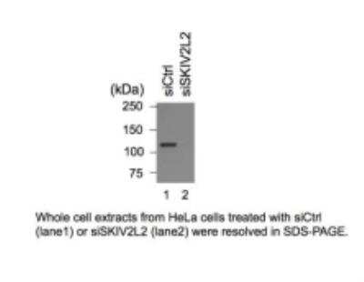 Western Blot: SKIV2L2 Antibody [NB100-1574]