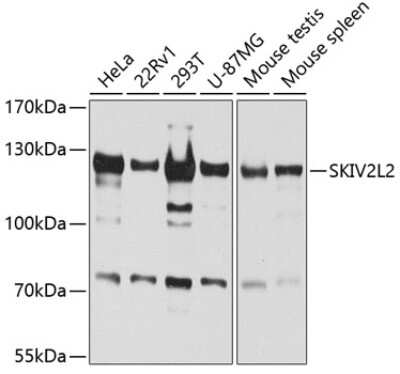 Western Blot: SKIV2L2 AntibodyBSA Free [NBP2-94315]