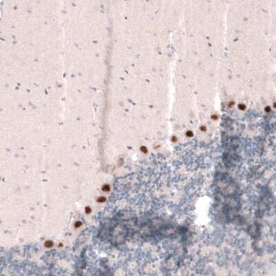 Immunohistochemistry-Paraffin: SKOR2 Antibody [NBP2-14565]