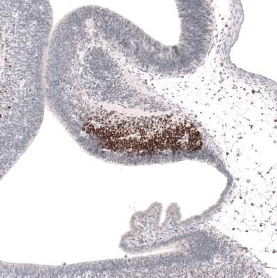 Immunohistochemistry-Paraffin: SKOR2 Antibody [NBP2-14565]