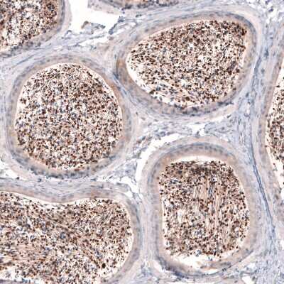 Immunohistochemistry-Paraffin: SKOR2 Antibody [NBP2-14565]