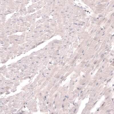 Immunohistochemistry-Paraffin: SKOR2 Antibody [NBP2-14565]