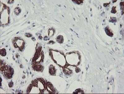 Immunohistochemistry: SLA2 Antibody (OTI3A7) [NBP2-45867]