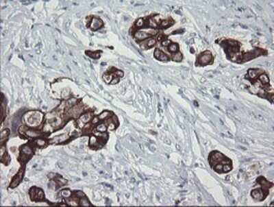 Immunohistochemistry: SLA2 Antibody (OTI3A7) [NBP2-45867]