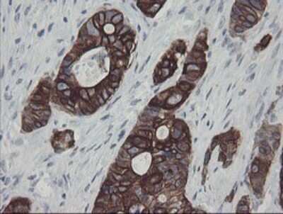 Immunohistochemistry: SLA2 Antibody (OTI3A7) [NBP2-45867]