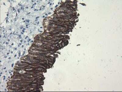 Immunohistochemistry: SLA2 Antibody (OTI3A7) [NBP2-45867]