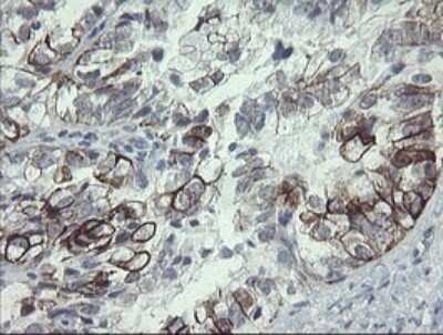 Immunohistochemistry: SLA2 Antibody (OTI3A7) [NBP2-45867]