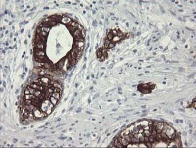 Immunohistochemistry: SLA2 Antibody (OTI3A7) - Azide and BSA Free [NBP2-74210]