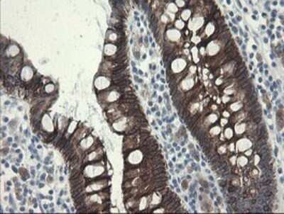 Immunohistochemistry: SLA2 Antibody (OTI3A7) - Azide and BSA Free [NBP2-74210]