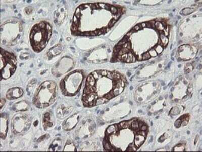 Immunohistochemistry: SLA2 Antibody (OTI3A7) - Azide and BSA Free [NBP2-74210]