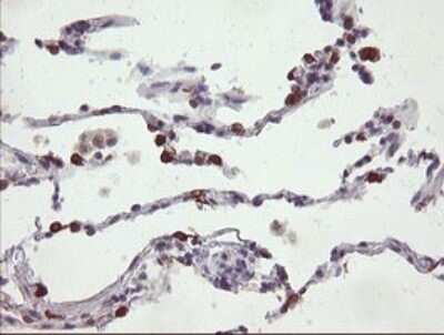 Immunohistochemistry: SLA2 Antibody (OTI3A7) - Azide and BSA Free [NBP2-74210]