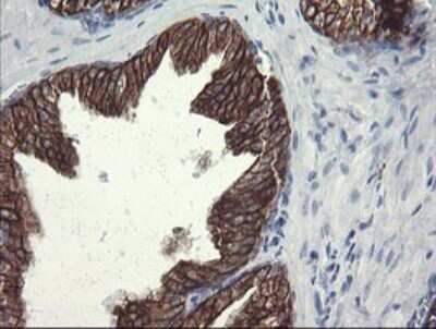 Immunohistochemistry: SLA2 Antibody (OTI3A7) - Azide and BSA Free [NBP2-74210]