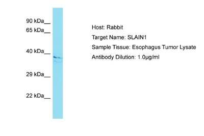 Western Blot: SLAIN1 Antibody [NBP2-82344]