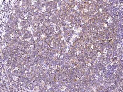 Immunohistochemistry-Paraffin: SLAM/CD150 Antibody (8) [NBP2-89678]
