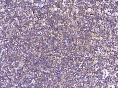 Immunohistochemistry-Paraffin: SLAM/CD150 Antibody (8) [NBP2-89678]