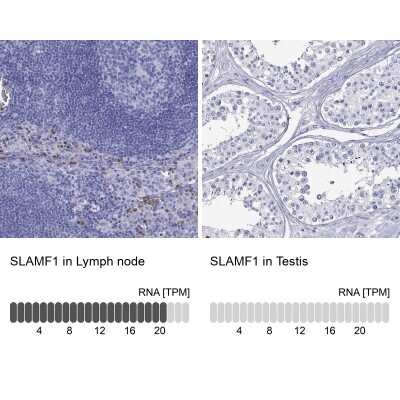 Immunohistochemistry-Paraffin: SLAM/CD150 Antibody [NBP2-62662]