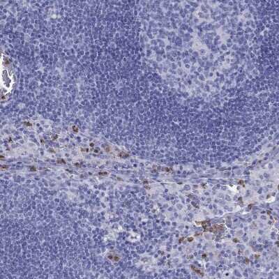 Immunohistochemistry-Paraffin: SLAM/CD150 Antibody [NBP2-62662]