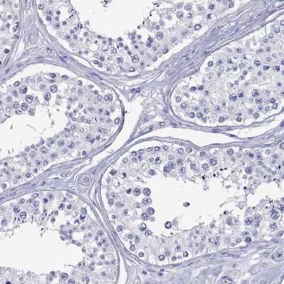 Immunohistochemistry-Paraffin: SLAM/CD150 Antibody [NBP2-62662]