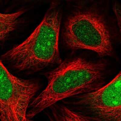 Immunocytochemistry/ Immunofluorescence: SLBP Antibody [NBP2-56007]