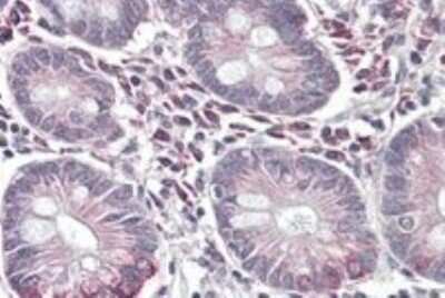 Immunohistochemistry-Paraffin: SLC10A2 Antibody [NBP1-36987]