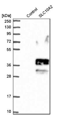 Western Blot: SLC10A2 Antibody [NBP1-88813]